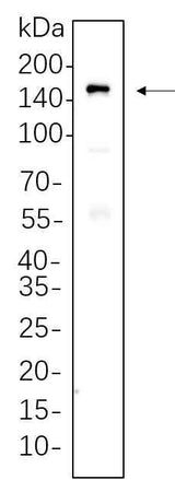 Anti-Human MDR1 Antibody [B762]