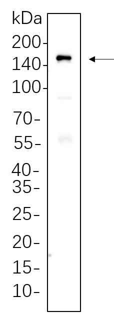 Anti-Human MDR1 Antibody [B762] - ABMIUM