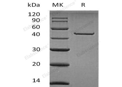 Recombinant Human Carboxypeptidase A2/CPA2 Protein (His Tag) - ABMIUM