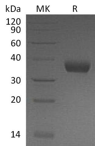 Recombinant Mouse PRLR/Prolactin Receptor Protein (His Tag) - ABMIUM