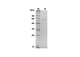 SDS-PAGE analysis of Human TNFRSF11B proteins, 2 μg/lane of Recombinant Human TNFRSF11B proteins was resolved with SDS-PAGE under reducing conditions, showing bands at 58 kDa.