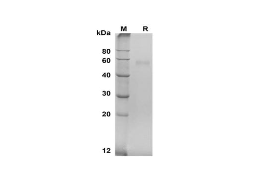 SDS-PAGE analysis of Human TNFRSF11B proteins, 2 μg/lane of Recombinant Human TNFRSF11B proteins was resolved with SDS-PAGE under reducing conditions, showing bands at 58 kDa.