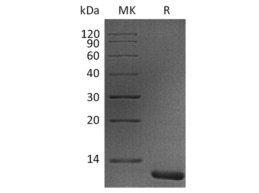 Recombinant Human S100A11 Protein - ABMIUM