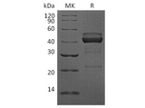 Recombinant Human TIGIT Protein (mFc Tag) - ABMIUM