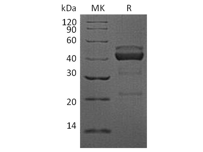 Recombinant Human TIGIT Protein (mFc Tag) - ABMIUM