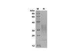 SDS-PAGE analysis of Mouse IL-13 proteins, 2 μg/lane of Recombinant Mouse IL-13 proteins was resolved with SDS-PAGE under reducing conditions, showing bands at 30-35 kDa.
