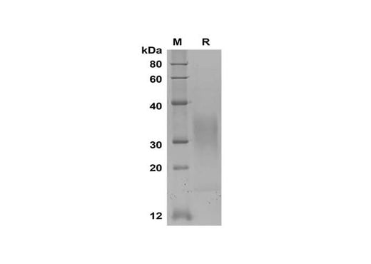 SDS-PAGE analysis of Mouse IL-13 proteins, 2 μg/lane of Recombinant Mouse IL-13 proteins was resolved with SDS-PAGE under reducing conditions, showing bands at 30-35 kDa.