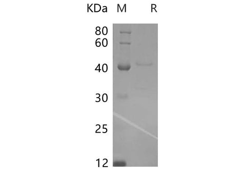 SDS-PAGE analysis of Rat LAMP3/CD208/DC-LAMP proteins, 2 μg/lane of Recombinant Rat LAMP3/CD208/DC-LAMP proteins was resolved with SDS-PAGE under reducing conditions, showing bands at 40.8 kDa.