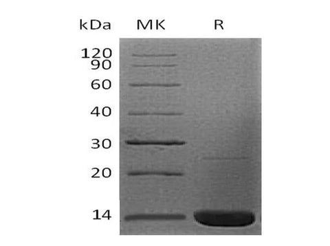 Recombinant Human Beta-2-Microglobulin/B2M Protein (E.coli, His Tag) - ABMIUM