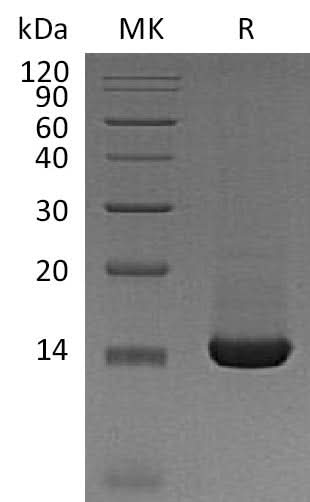 Recombinant Mouse Trefoil Factor 2/TFF2 Protein (His Tag) - ABMIUM