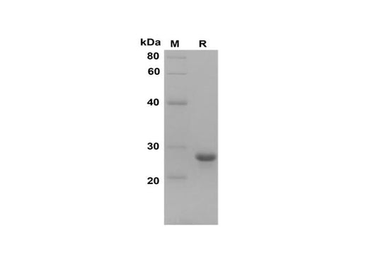 SDS-PAGE analysis of Human PP proteins, 2 μg/lane of Recombinant Human PP proteins was resolved with SDS-PAGE under reducing conditions, showing bands at 27 kDa.