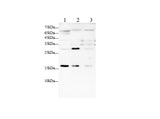 Anti-Human/Mouse IL-7 Antibody - ABMIUM