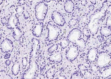 Anti-Human TP63 Antibody [A1250] - ABMIUM