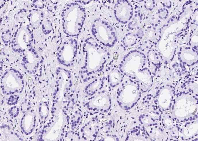 Anti-Human TP63 Antibody [A1250] - ABMIUM