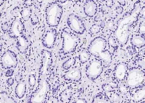 Anti-Human TP63 Antibody [A1250] - ABMIUM
