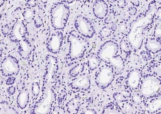 Anti-Human TP63 Antibody [A1250] - ABMIUM