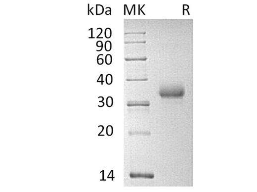 Recombinant Human CD2 Protein (His Tag) - ABMIUM