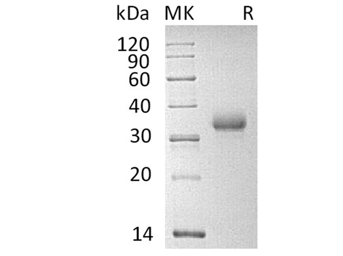 Recombinant Human CD2 Protein (His Tag) - ABMIUM