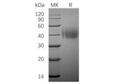 Recombinant Human SLAMF7/CD319 Protein (His Tag) - ABMIUM
