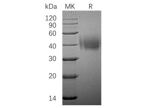 Recombinant Human SLAMF7/CD319 Protein (His Tag) - ABMIUM