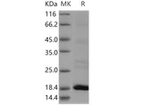 Recombinant Human Flavokinase/RFK Protein (His Tag) - ABMIUM