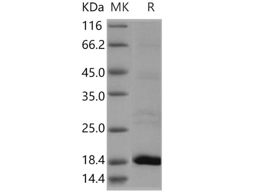 Recombinant Human Flavokinase/RFK Protein (His Tag) - ABMIUM