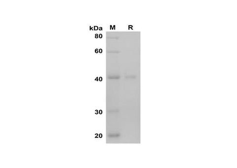 SDS-PAGE analysis of Mouse IFN-γ proteins, 2 μg/lane of Recombinant Mouse IFN-γ proteins was resolved with SDS-PAGE under reducing conditions, showing bands at 40 kDa.