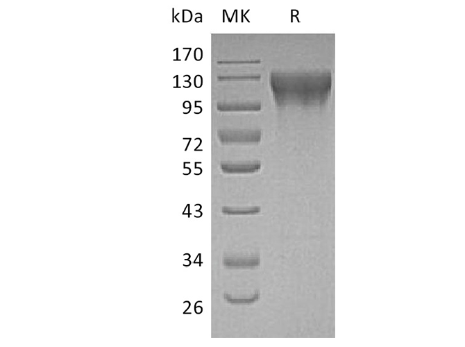 Recombinant Human ECE1 Protein (His Tag) - ABMIUM