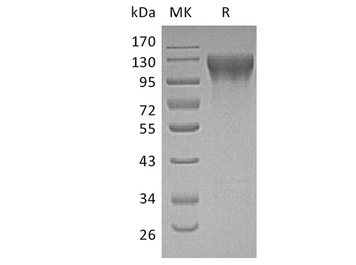 Recombinant Human ECE1 Protein (His Tag) - ABMIUM
