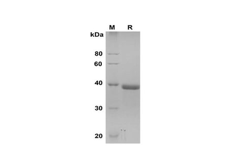 SDS-PAGE analysis of Human SPARC proteins, 2 μg/lane of Recombinant Human SPARC proteins was resolved with SDS-PAGE under reducing conditions, showing bands at 38 kDa.