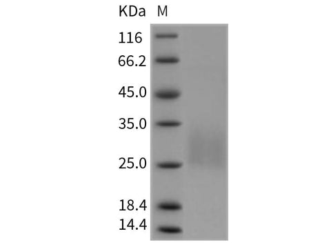 > 78 % as determined by reducing SDS-PAGE.