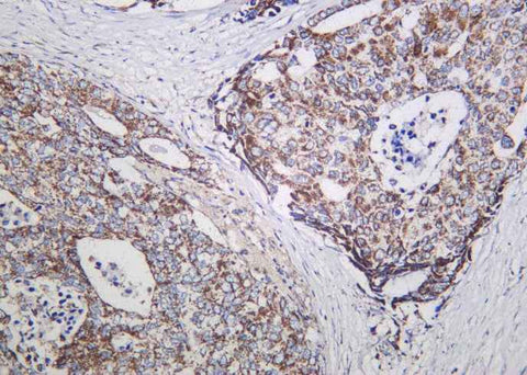 Anti-Human/Mouse/Rat NDUFS1 Antibody [B924] - ABMIUM