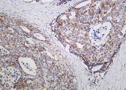 Anti-Human/Mouse/Rat NDUFS1 Antibody [B924] - ABMIUM