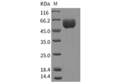 Recombinant Mouse SMPDL3A Protein (His Tag) - ABMIUM