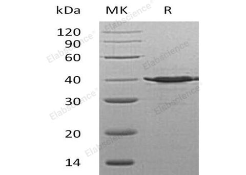 Recombinant Human TSTA3/SDR4E1 Protein (His Tag) - ABMIUM