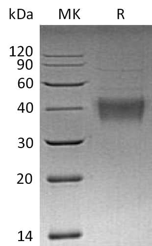 Recombinant Mouse TNFSF9 Protein (His Tag) - ABMIUM