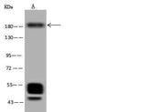 Anti-Human MET Antibody [A1036] - ABMIUM