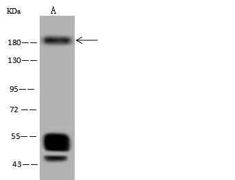 Anti-Human MET Antibody [A1036] - ABMIUM