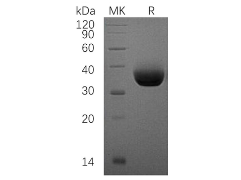 Recombinant Human PD-L1/B7-H1/CD274 Protein (His Tag) - ABMIUM