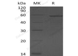Recombinant Human Growth Arrest-Specific Protein 7/GAS7 Protein (His Tag) - ABMIUM