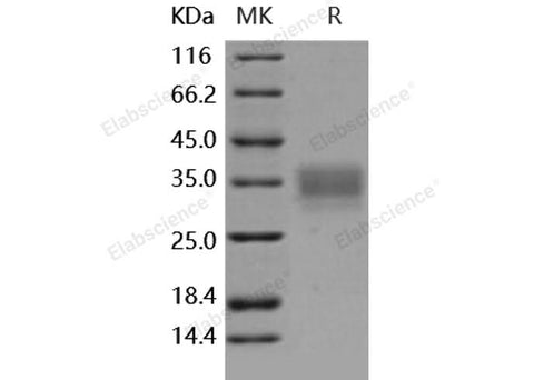 Recombinant Human CD147/Basigin Protein - ABMIUM