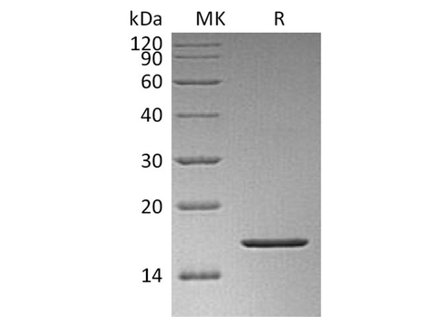 Recombinant Human FGF-2/FGF basic/FGFb Protein - ABMIUM