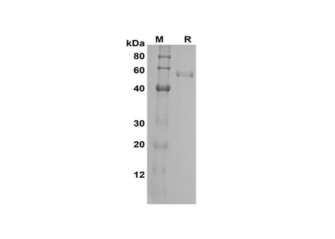 SDS-PAGE analysis of Human FGF23 proteins, 2 μg/lane of Recombinant Human FGF23 proteins was resolved with SDS-PAGE under reducing conditions, showing bands at 55 kDa.