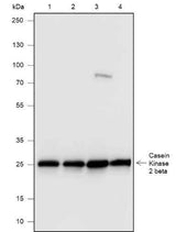 Anti-Human/Rat/Mouse Casein Kinase 2 beta Antibody [A532]