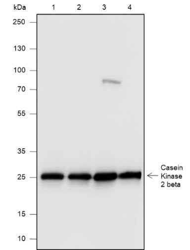 Anti-Human/Rat/Mouse Casein Kinase 2 beta Antibody [A532]