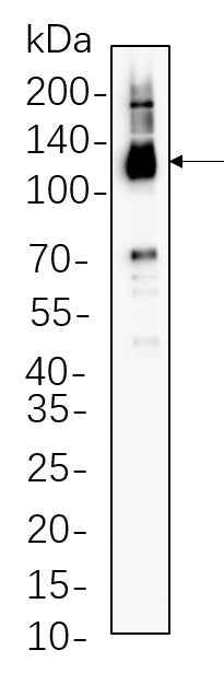 Anti-Human/Mouse/Rat Notch2 Antibody [B1138] - ABMIUM