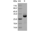 Recombinant Human AKT3 Protein (GST Tag) - ABMIUM