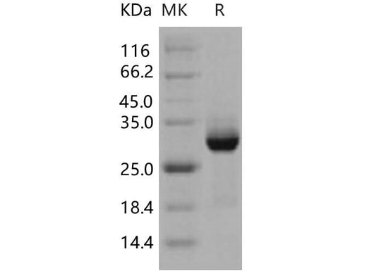 Recombinant Human AKT3 Protein (GST Tag) - ABMIUM
