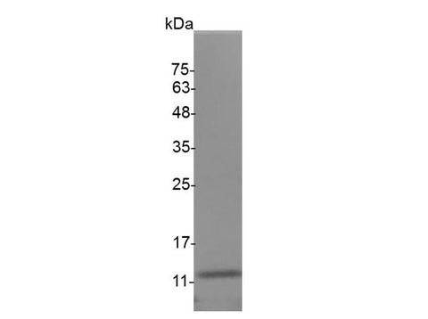 Recombinant Mouse IL-5 protein(His Tag) - ABMIUM
