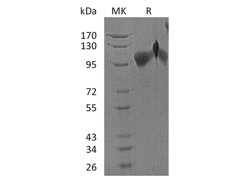 Recombinant Human BMPR2 Protein (Fc & His Tag) - ABMIUM